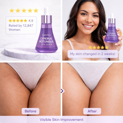 Viareline Hair Removal Aftercare Essence
